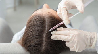 PRP Therapy