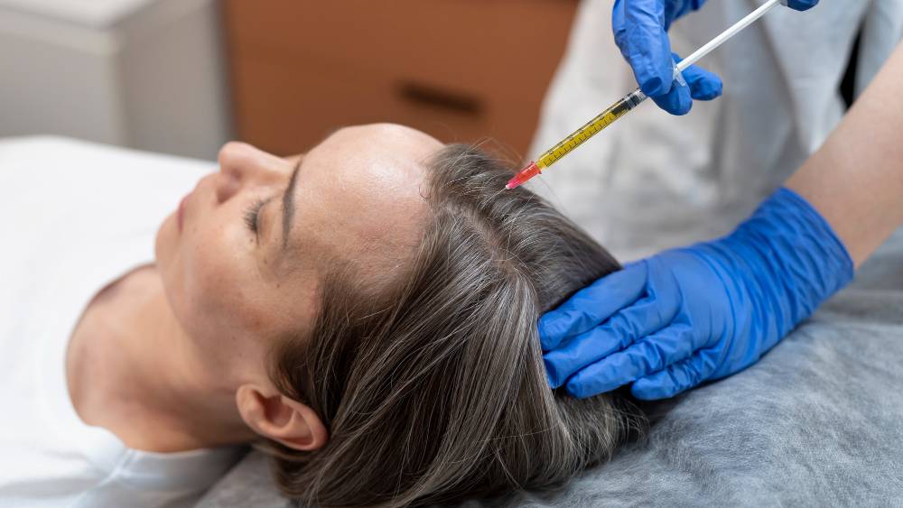 Scalp Micropigmentation