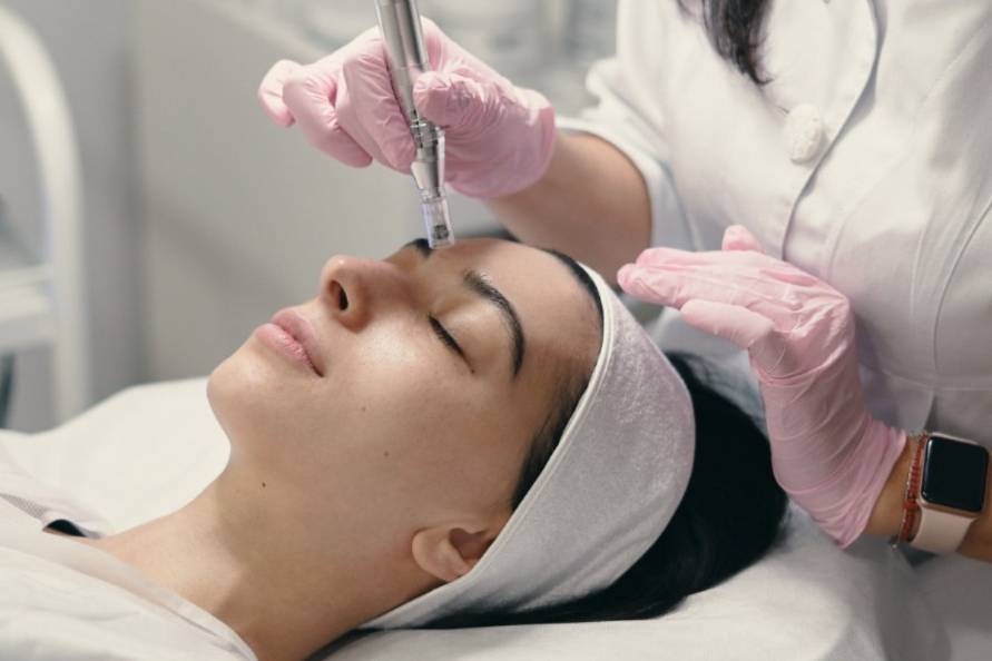 Microdermabrasion