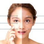 skin whitening treatment in chennai