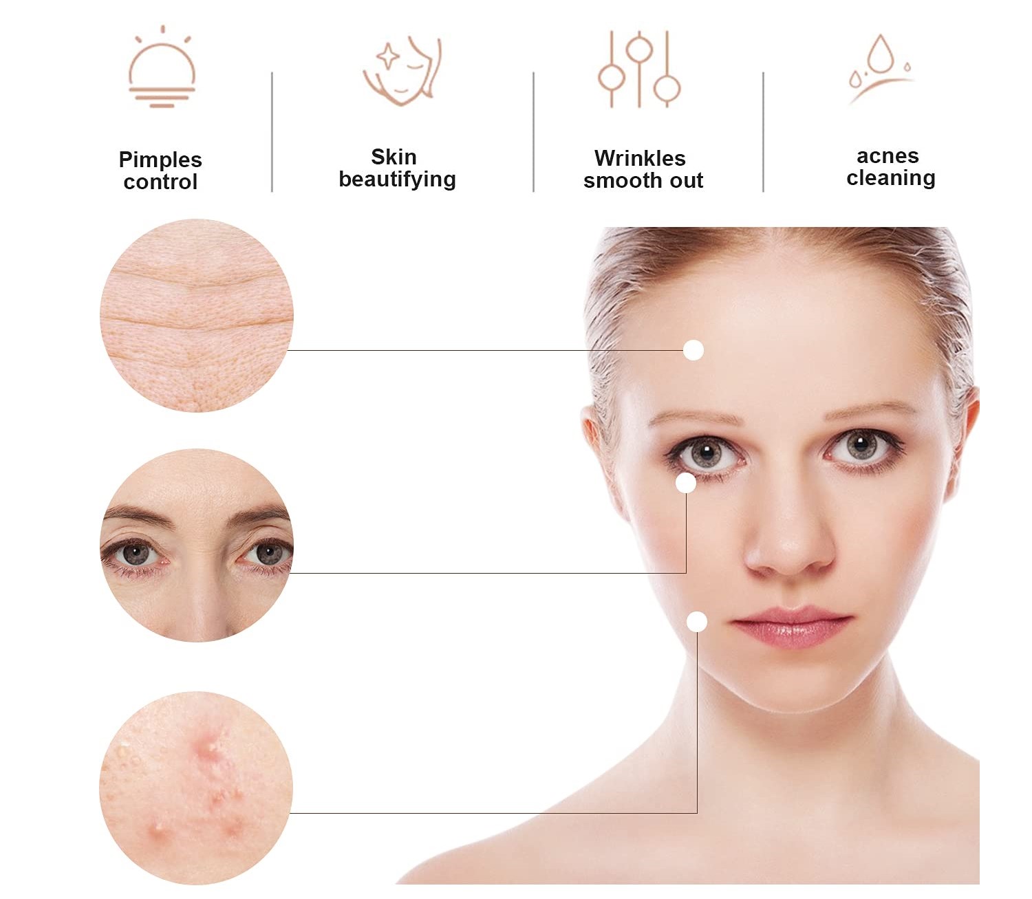 laser hair removal