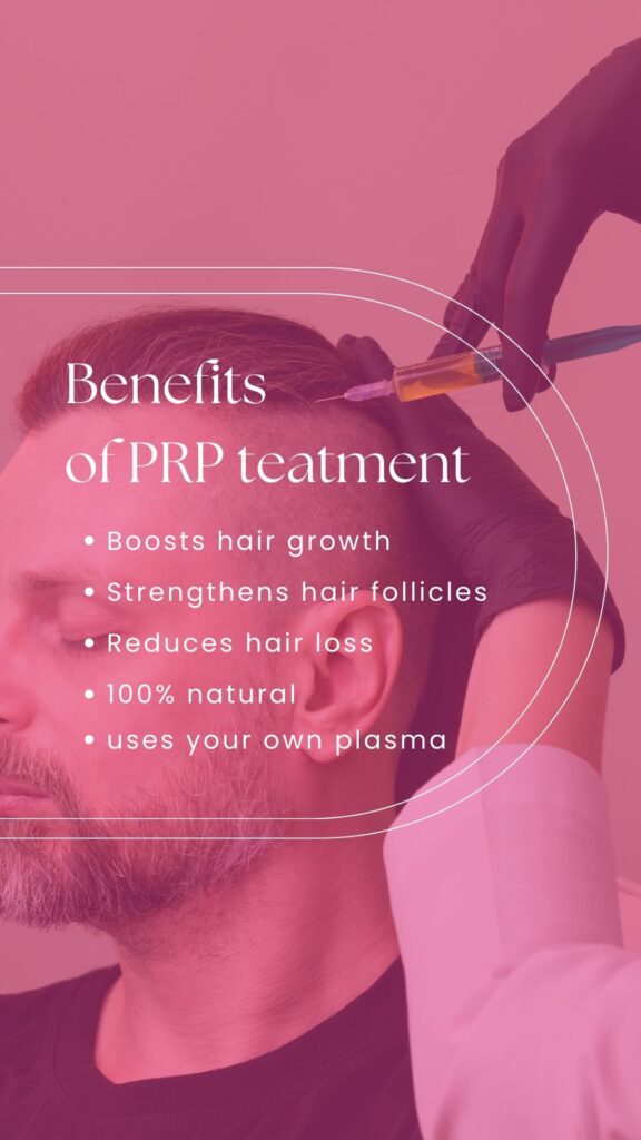 PRP for hair loss