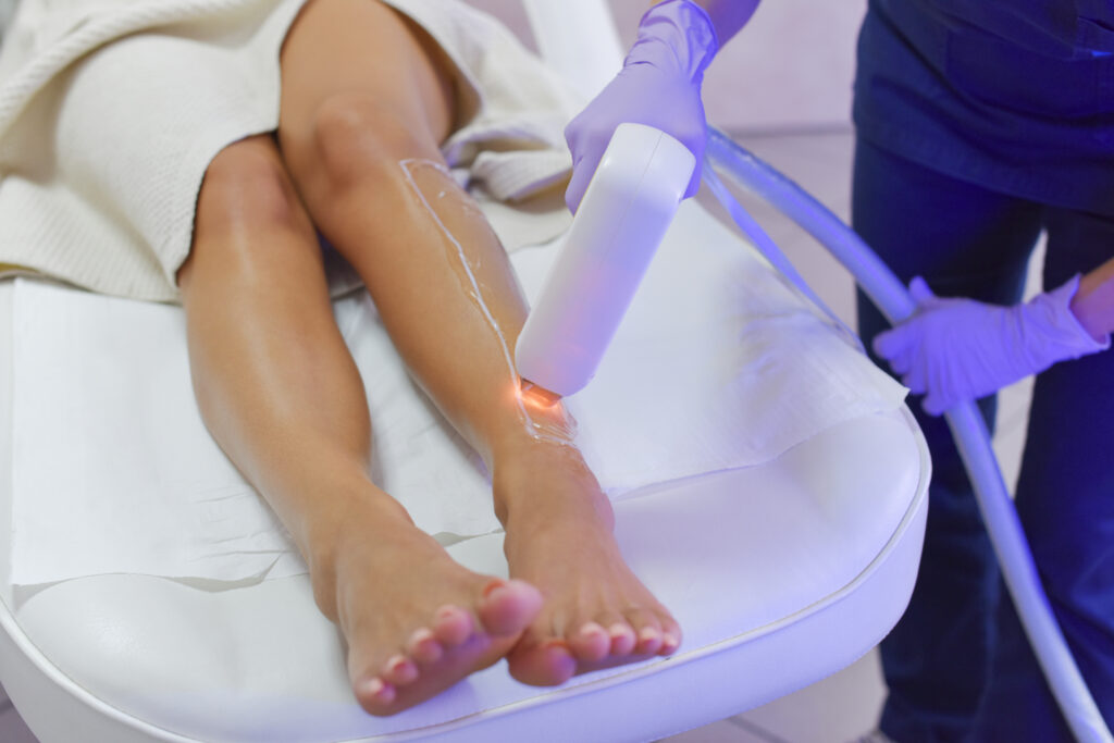 Laser hair removal in chennai