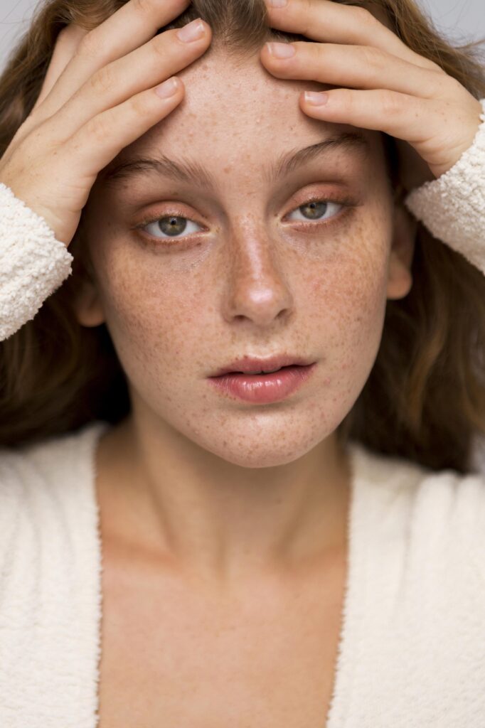 chemical peel for pigmentation