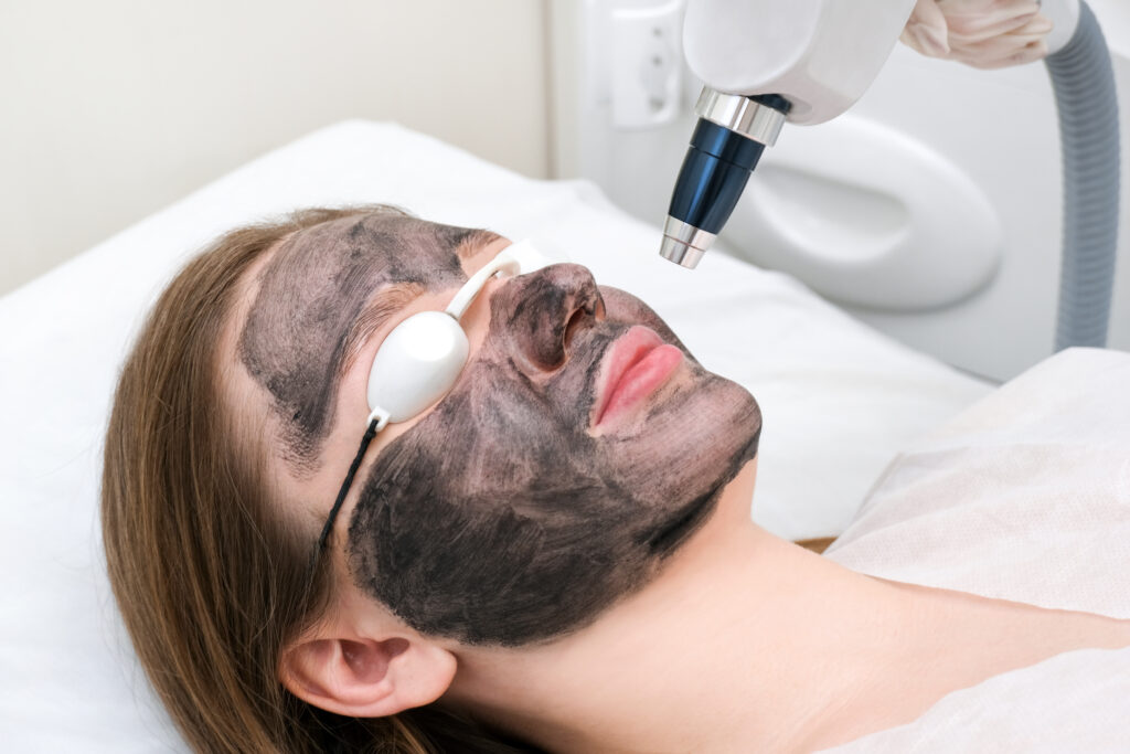 pigmentation treatment in chennai