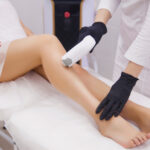 laser hair removal near me