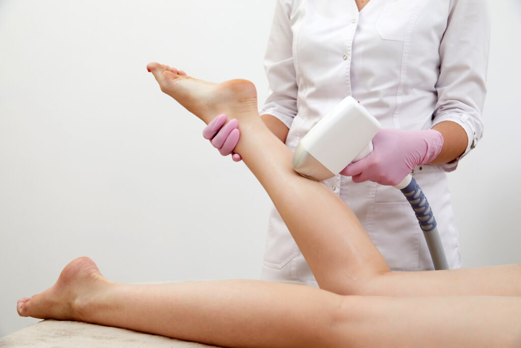 Laser hair removal