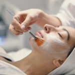 Chemical Peel for Hyperpigmentation