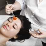 Chemical Peel for Skin Whitening