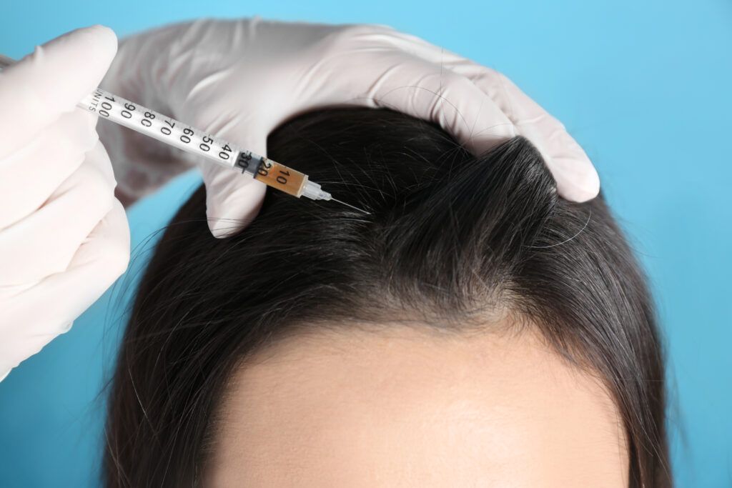 prp hair treatment