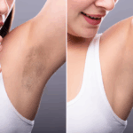 shaving vs waxing for underarms