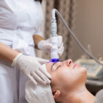 hydrafacial for acne