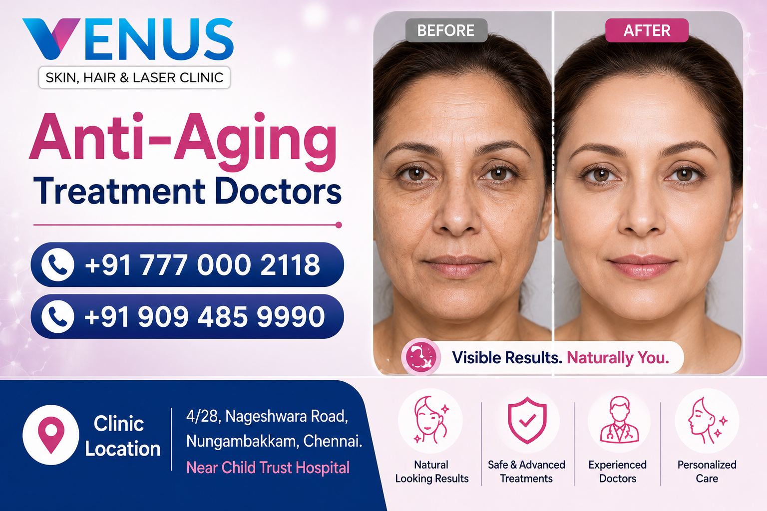 Anti-Aging Treatment Doctors In Chennai
