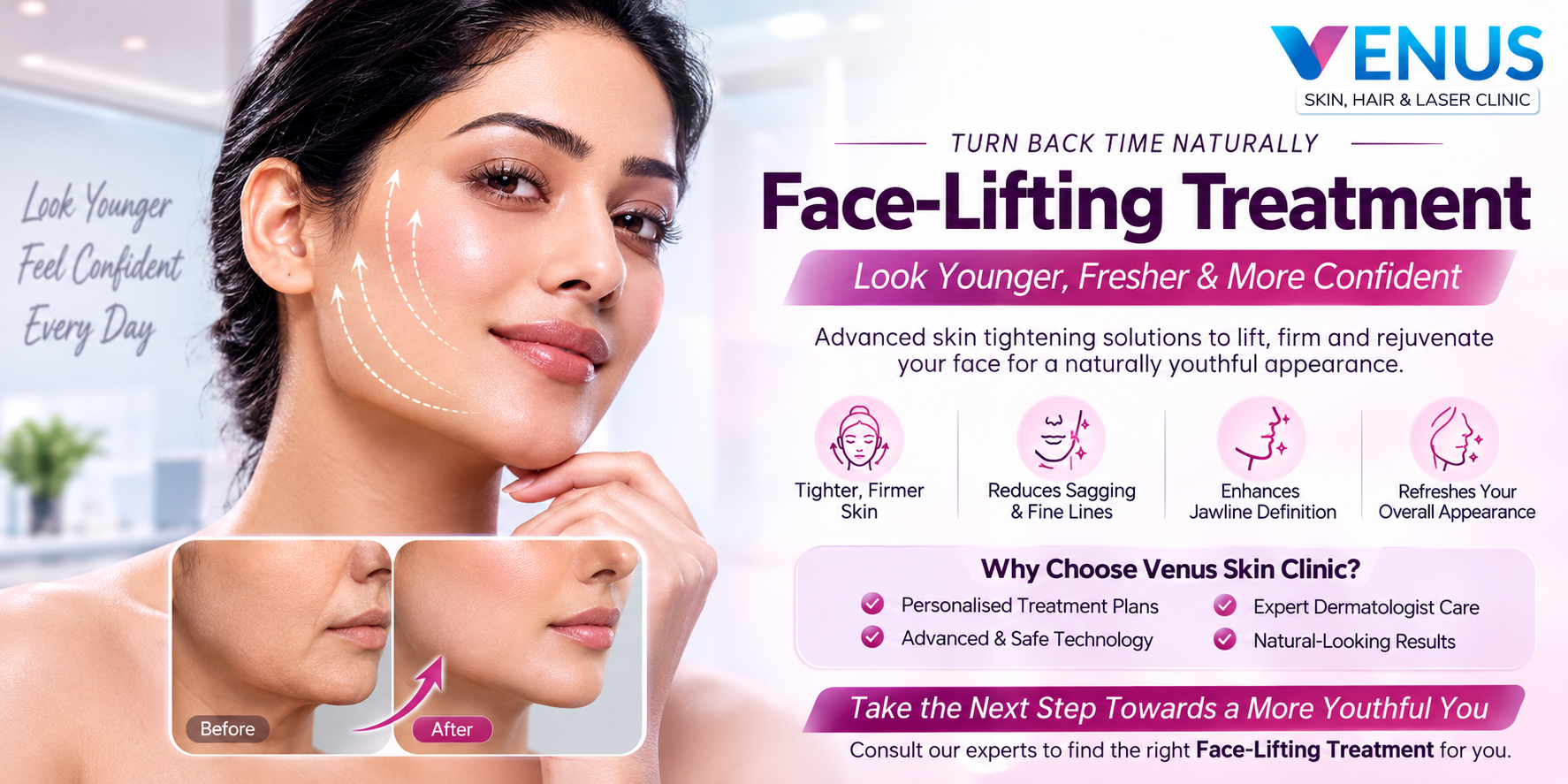 Face Lifting Treatment in Chennai