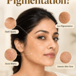 Pico laser for pigmentation treatment for dark spots and uneven skin tone in Chennai